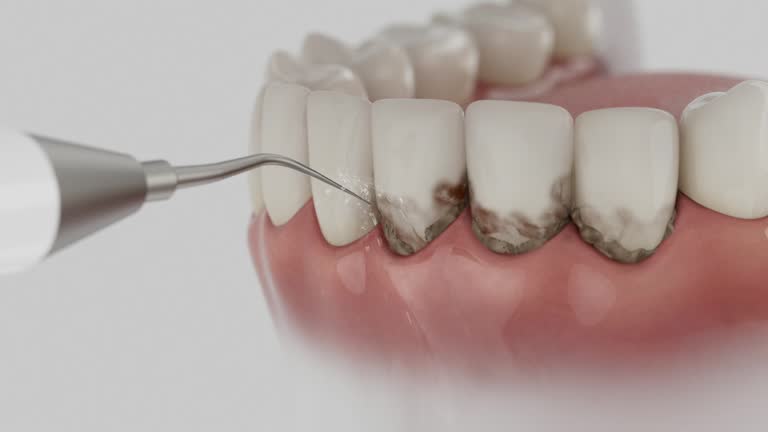 Reliable Wisdom Tooth Removal contractor in Natrona County County, WY by Dentist Open Now